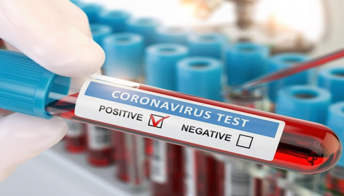 Azərbaycanda daha 517 nəfər koronavirusa yoluxub, 7 nəfər ölüb