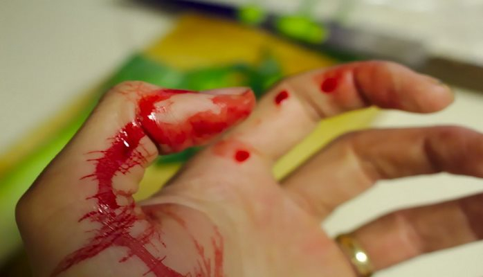 Медики научились определять силу боли по анализу крови