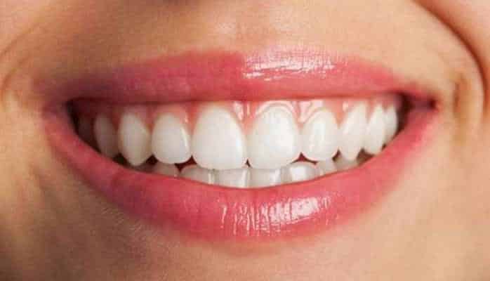 Dişlərin ağardılmasının ən yaxşı üsulları