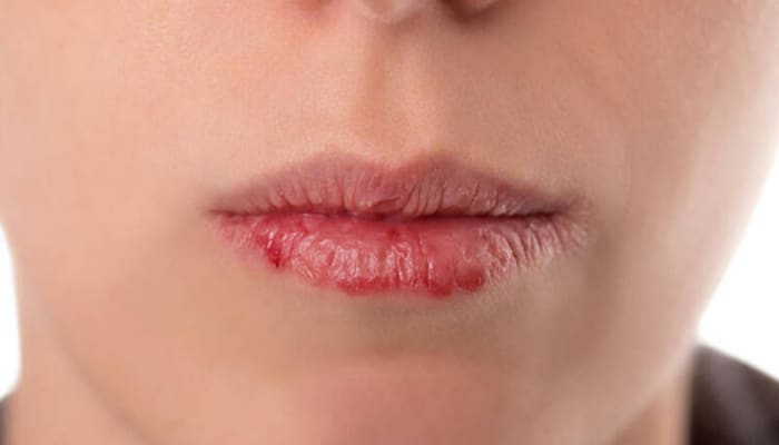 Dodaqlarınız sağlamlığınız haqqında nə deyir?