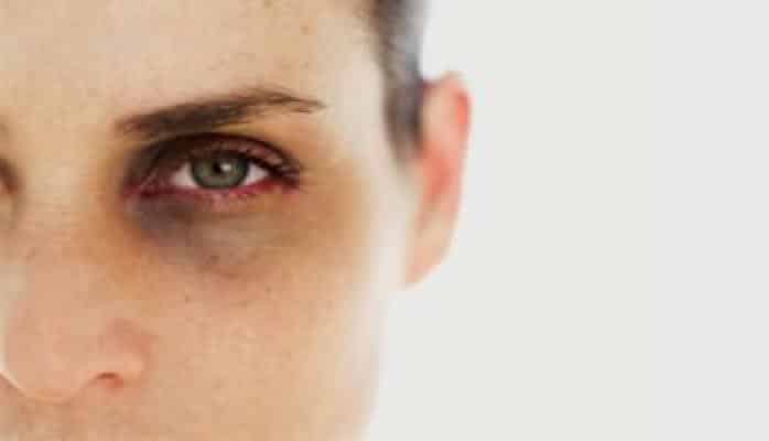 Названы способы определить нехватку витамина В12 по глазам
