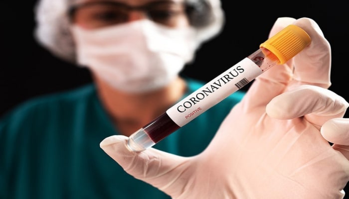 США предоставят Армении 1,1 млн. долларов на борьбу с коронавирусом