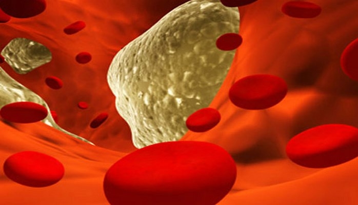 Damarları təmizləyən qidalar