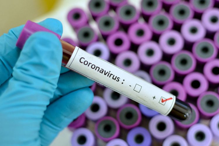 Azərbaycanda indiyədək 508811 koronavirus testi aparılıb