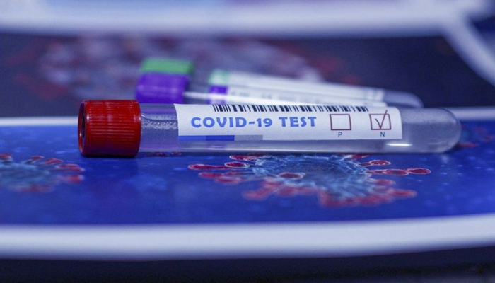 Azərbaycanda ümumilikdə 910 890 koronavirus testi aparılıb