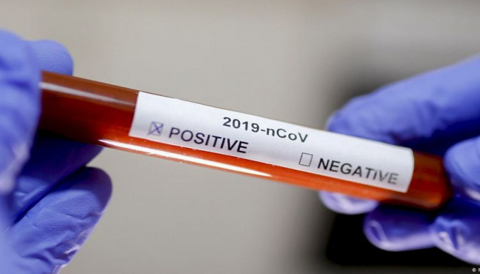 В России за сутки выявили 5 504 заразившихся коронавирусом
