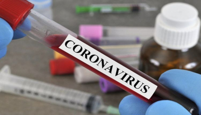 Число умерших от коронавируса в России превысило 19 тысяч
