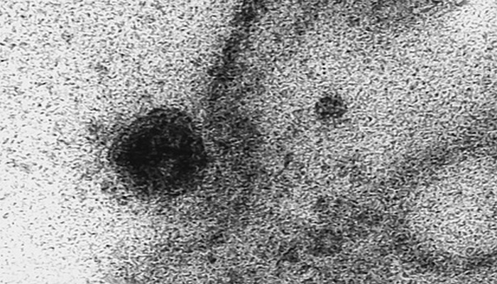 Момент заражения коронавирусом показали под микроскопом