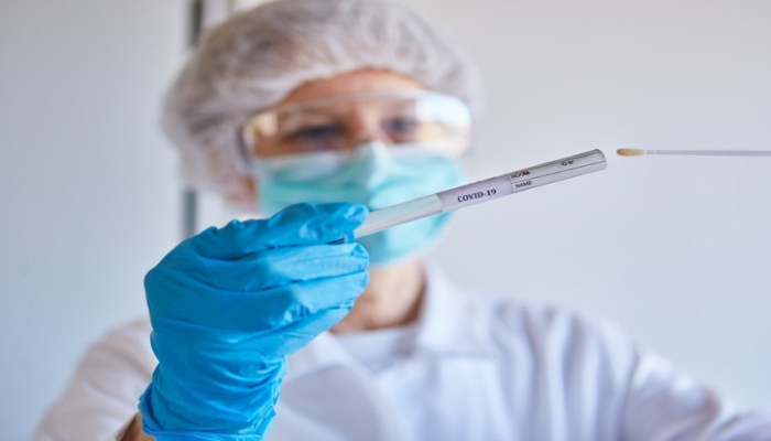 Azərbaycanda daha 121 nəfərdə koronavirus aşkarlandı, 44 nəfər sağaldı