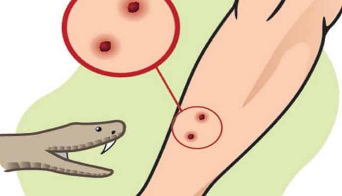 İlan sancan adama bunu etsəniz zəhər qana keçməz - Həkimə qədər!