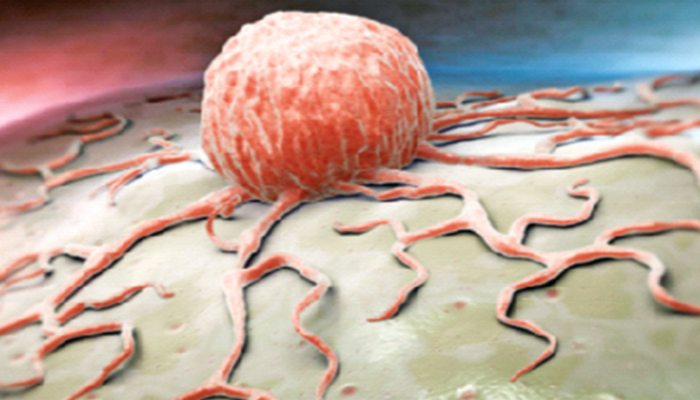 “Gözdən əlil və əqli zəif olanlar xərçəngə tutulmur” iddiası