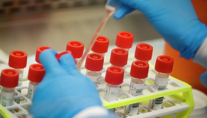 ABŞ-da 8 mindən çox hərbçi və ailə üzvlərində koronavirus aşkarlanıb