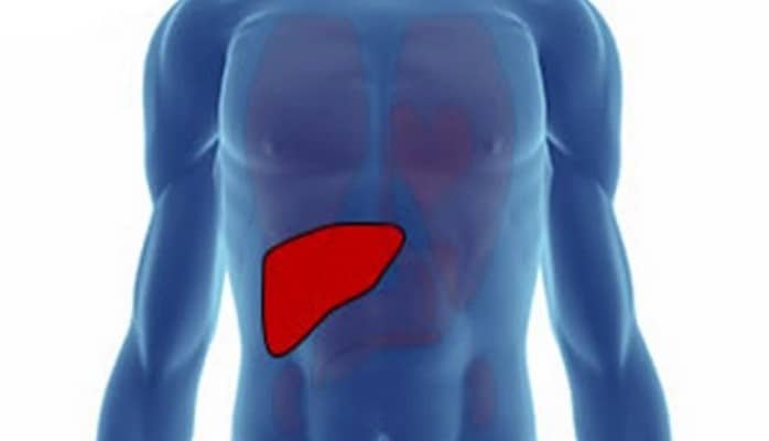 Qaraciyər xəstəliyinin əlamətləri