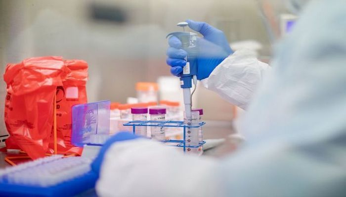 Bunlara diqqət edilməzsə, koronavirus testi səhv nəticə verə bilər