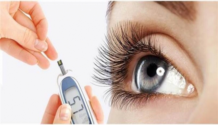 Şəkər xəstələrində hansı göz problemləri yaranır?
