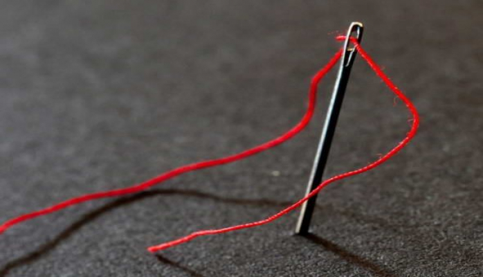 Azərbaycanlı qadının səhvən udduğu iynə 16 il sonra çıxarıldı