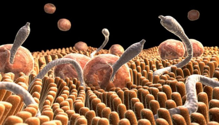 Qurdu olan insan necə qidalanmalıdır? – Olar-Olmaz