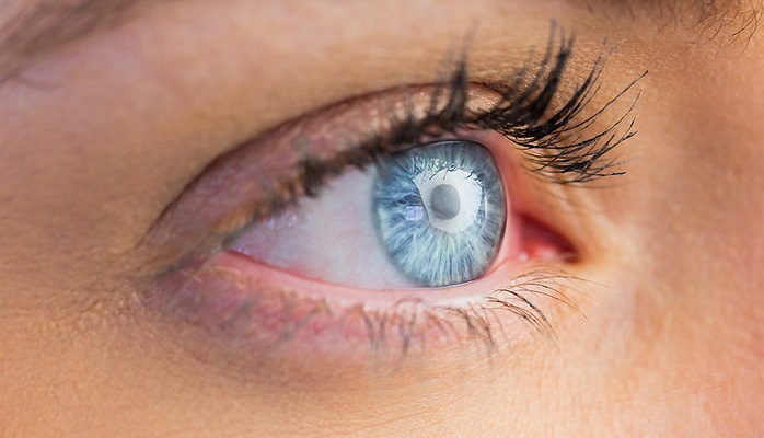 Gözünüzdəki bu problem xərçəngin əlamətidir