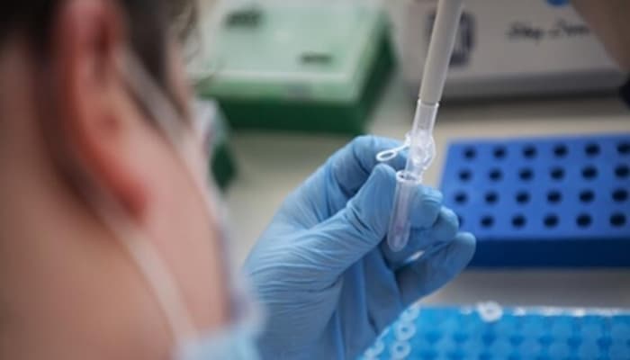 İsveç həkimləri koronavirusun müalicəsində bu dərmandan imtina etdi