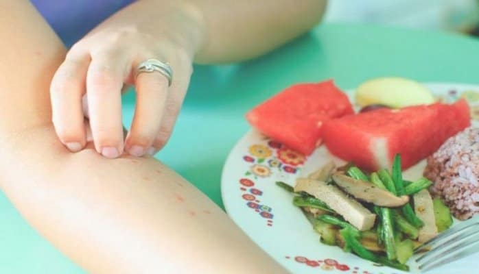 Qidaya allergiyanız olduğunu göstərən əlamətlər