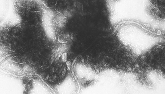 Ölümcül və geniş yayılmış infeksiyanın mexanizmi aşkar edildi