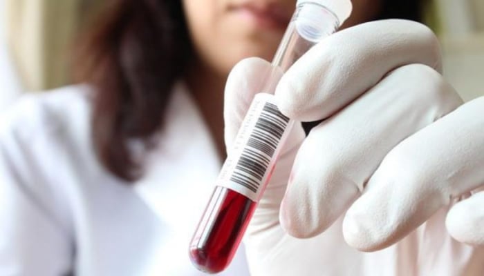 İran koronavirusun dərmanını tapdı - 3 həftəyə satışa çıxarılacaq