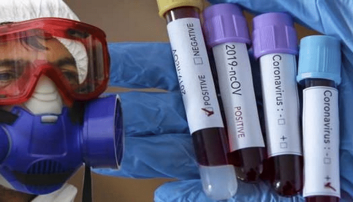 Koronavirusa qarşı 3 vacib mübarizə növü – Mütləq əməl edin!