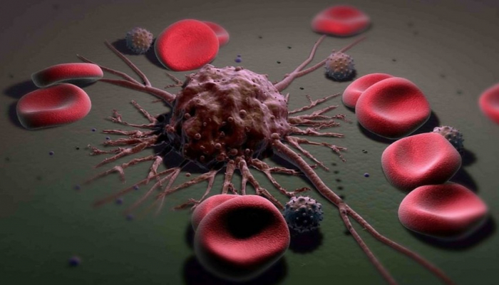 Alimlər xərçəng xəstəliyinin metastazına üstün gəlmək üsulunu tapıblar