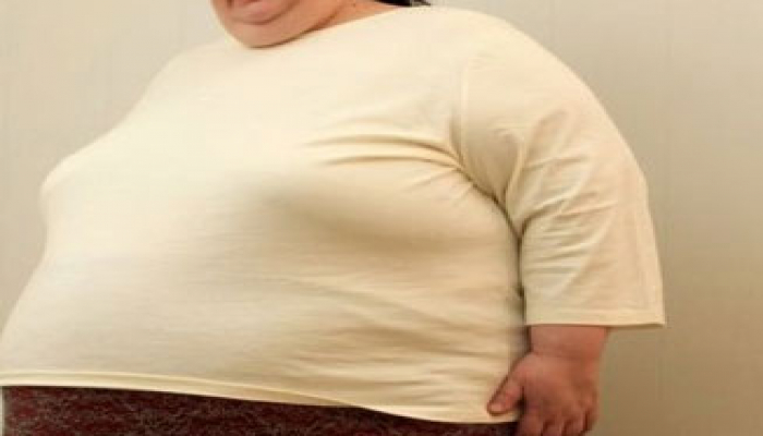 Ученые выяснили, что ожирение повышает риск развития опасных заболеваний почти на 70%