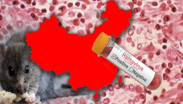 Koronavirusun davamı Hantavirus - ƏLAMƏTLƏRİ