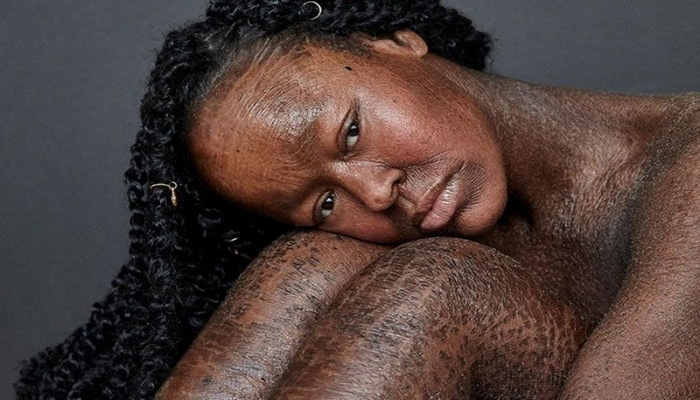 İki həftədən bir dərisi dəyişən model