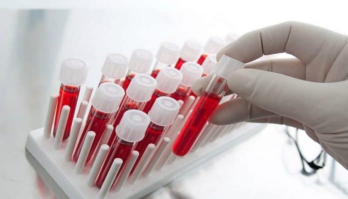 Новый анализ крови поможет узнать о риске рецидива рака