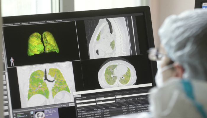 Koronaviruslu xəstə müalicə xərclərindən şok keçirdi - 1 milyon dollar…