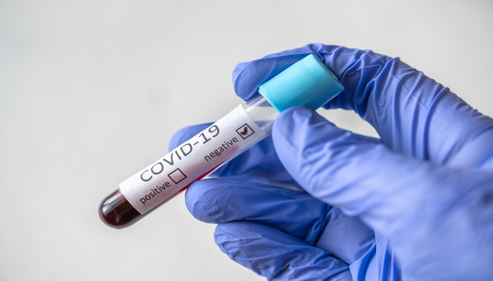 Koronavirus profilaktikasının təhlükəli metodları açıqlanıb