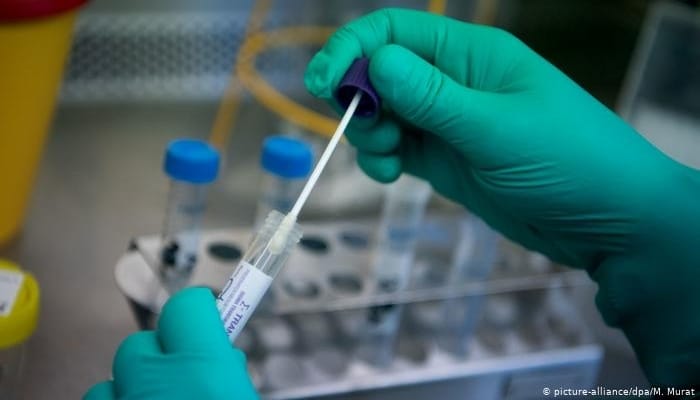 Ученые заявили о новом способе заражения коронавирусом