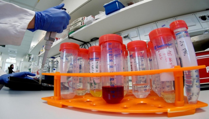 В России выявили более тысячи  новых случаев заражения коронавирусом