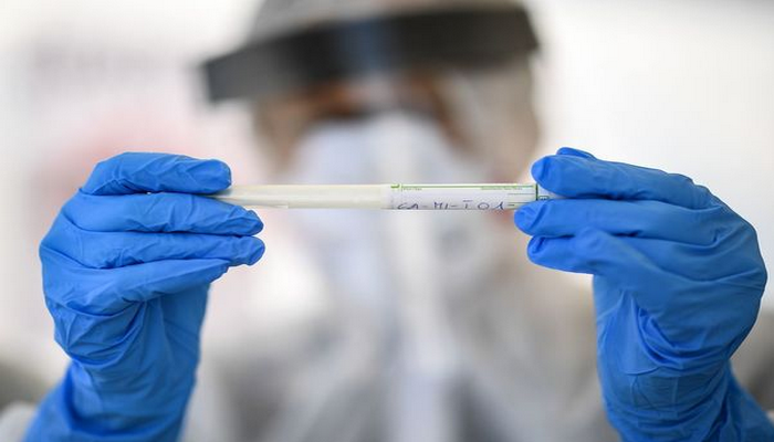 Azərbaycanda nazirliyin 15 əməkdaşında koronavirus aşkarlandı - RƏSMİ AÇIQLAMA