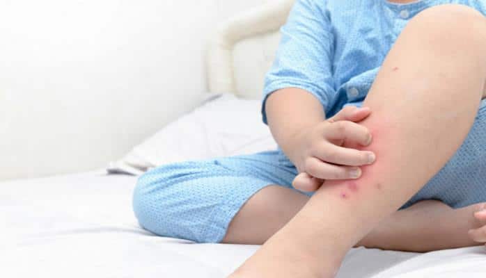 Первые признаки тромба, которые нельзя игнорировать