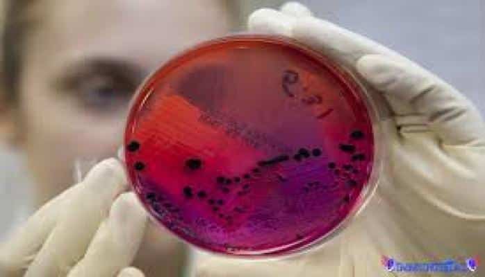 AQTA-dan qara yara xəstəliyi ilə bağlı açıqlama