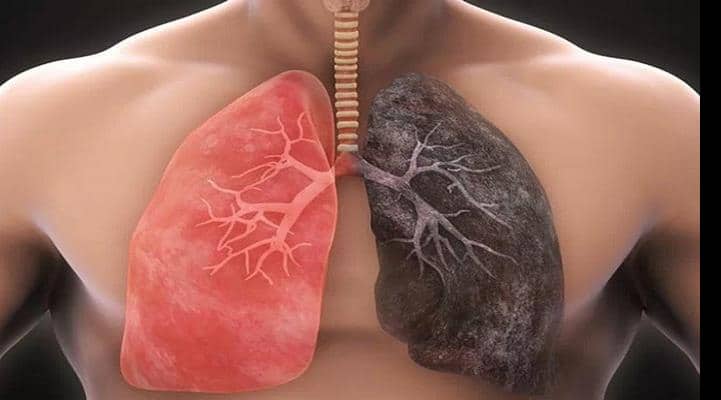 Bu qidalar ağciyəri toksinlərdən təmizləyir