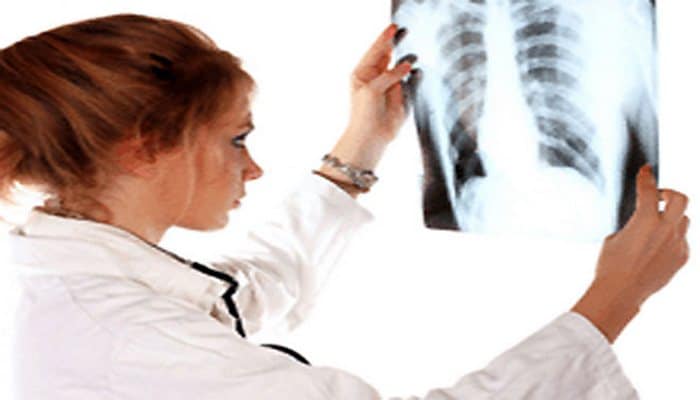 Xərçəng xəstələri koronavirusdan necə qorunmalıdır?