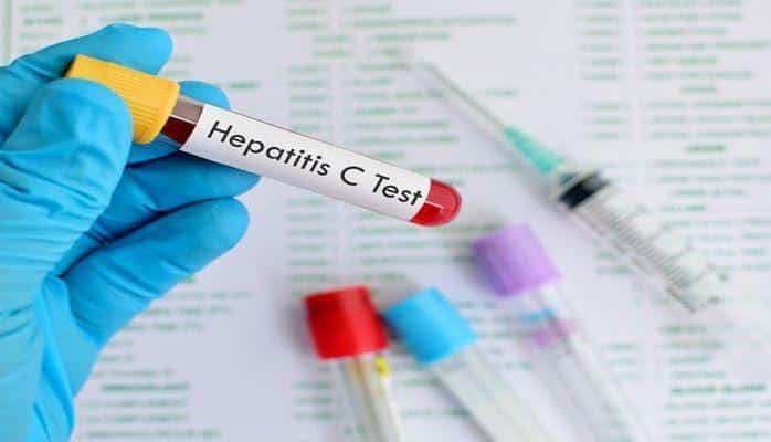 Hepatit C