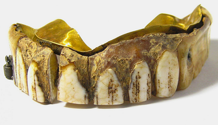 Найдена 200-летняя вставная челюсть из золота и кости