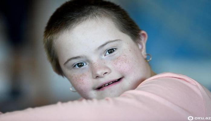 Əskik deyil, bir xromosom daha çox: Təbəssümün ən çox yaraşdığı mələklərlə bir gün