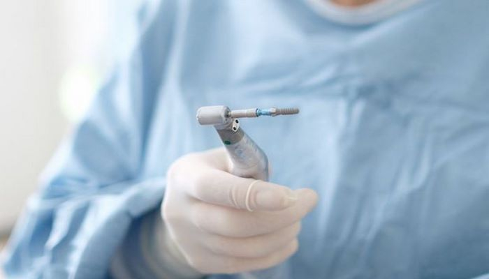 Зубные имплантаты могут быть опасными