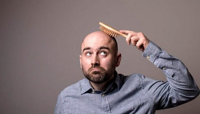 Keçəl kişilərdə koronavirusdan ölüm nisbəti daha yüksəkdir-Professor AÇIQLADI