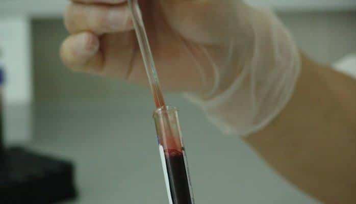 Ученые нашли у человека неизвестный тип кровеносных сосудов
