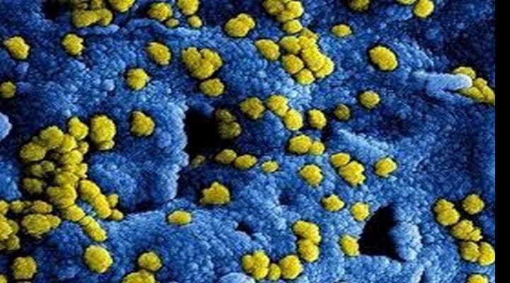 Koronavirusun müalicəsi tapılıb - Virusa yoluxanların sayı 617 nəfərə çatıb