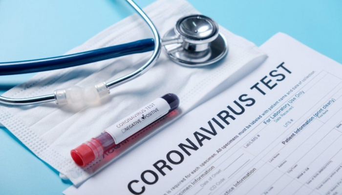 Operativ Qərargah: Daha 162 nəfər koronavirusa yoluxub