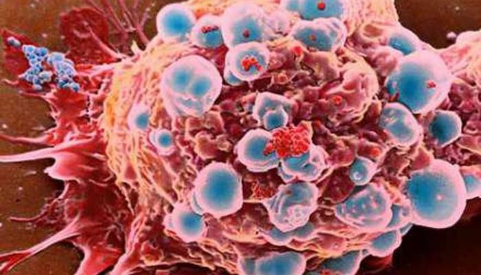 Bibər xərçəngi yox edir